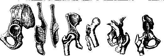 Pertussis: figure 19 from the 1928–1936 encyclopedia article