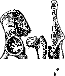Pertussis: figure 14 from the 1928–1936 encyclopedia article