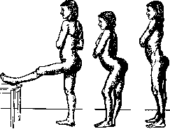 Pertussis: figure 24 from the 1928–1936 encyclopedia article