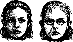 Strabismus: figure 6 from the 1928–1936 encyclopedia article