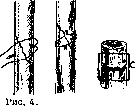 Bone Suture: figure 3 from the 1928–1936 encyclopedia article