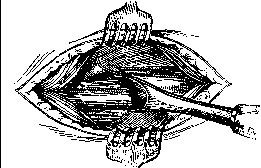 Bone Suture: figure 1 from the 1928–1936 encyclopedia article