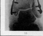 Bone: figure 11 from the 1928–1936 encyclopedia article