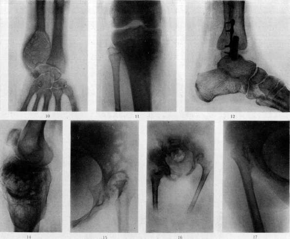 Bone: figure 12 from the 1928–1936 encyclopedia article