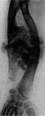 Bone: figure 10 from the 1928–1936 encyclopedia article