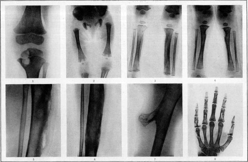 Bone: figure 9 from the 1928–1936 encyclopedia article