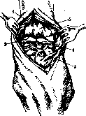 Radiocarpal Joint: figure 13 from the 1928–1936 encyclopedia article