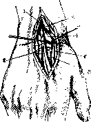 Radiocarpal Joint: figure 12 from the 1928–1936 encyclopedia article
