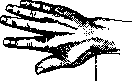 Radiocarpal Joint: figure 10 from the 1928–1936 encyclopedia article