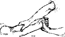 Massage: figure 2 from the 1928–1936 encyclopedia article
