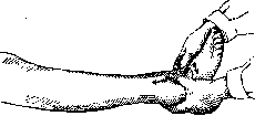 Massage: figure 8 from the 1928–1936 encyclopedia article