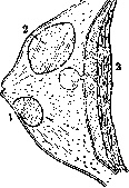 Mastitis: figure 2 from the 1928–1936 encyclopedia article