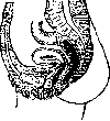 Uterus: figure 3 from the 1928–1936 encyclopedia article