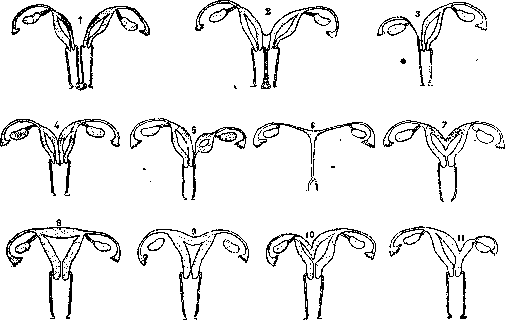 Uterus: figure 9 from the 1928–1936 encyclopedia article