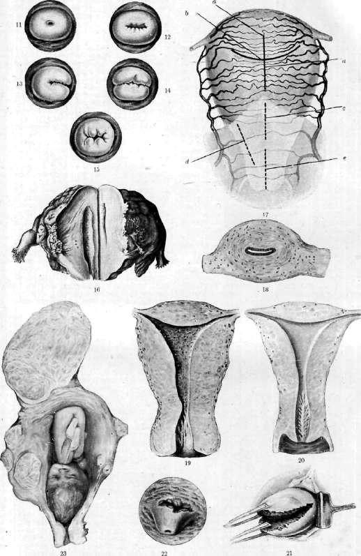 Uterus: figure 6 from the 1928–1936 encyclopedia article