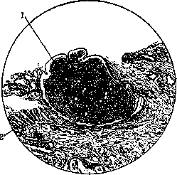 Uterus: figure 12 from the 1928–1936 encyclopedia article