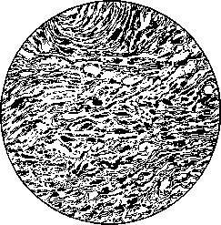 Uterus: figure 20 from the 1928–1936 encyclopedia article