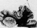 Mechanics of Development: figure 12 from the 1928–1936 encyclopedia article
