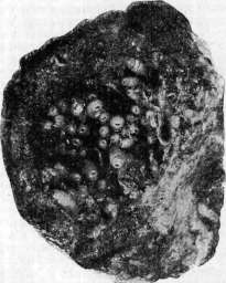 Myiasis (myiasis): figure 6 from the 1928–1936 encyclopedia article