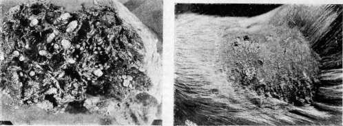 Myiasis (myiasis): figure 5 from the 1928–1936 encyclopedia article