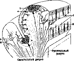 Cerebellopontine Angle: figure 21 from the 1928–1936 encyclopedia article