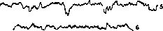 Electrical: figure 2 from the 1928–1936 encyclopedia article