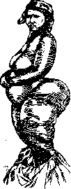 Gluteal Region: figure 3 from the 1928–1936 encyclopedia article
