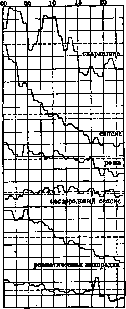 Acute Rheumatism: figure 2 from the 1928–1936 encyclopedia article
