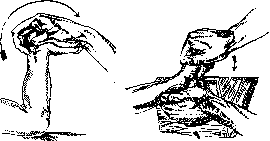 Regression: figure 5 from the 1928–1936 encyclopedia article