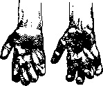 Rudolphi: figure 2 from the 1928–1936 encyclopedia article