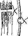 Sclera: figure 1 from the 1928–1936 encyclopedia article
