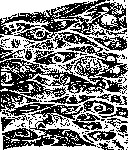 Scleroma: figure 2 from the 1928–1936 encyclopedia article