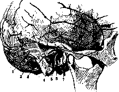 Mastoid Process: figure 7 from the 1928–1936 encyclopedia article