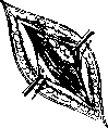Sexual Sterilization: figure 9 from the 1928–1936 encyclopedia article
