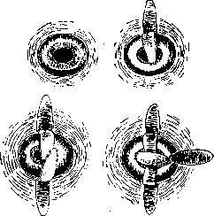 Sexual Sterilization: figure 4 from the 1928–1936 encyclopedia article