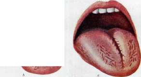 Ilya Strashun: figure 2 from the 1928–1936 encyclopedia article
