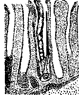 Strongyloidiasis: figure 2 from the 1928–1936 encyclopedia article