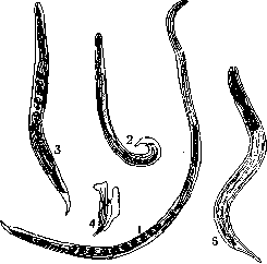 Strongyloidiasis: figure 1 from the 1928–1936 encyclopedia article