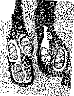 Strongyloidiasis: figure 3 from the 1928–1936 encyclopedia article