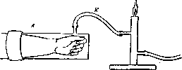 Tachography: figure 5 from the 1928–1936 encyclopedia article