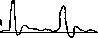 Tachography: figure 2 from the 1928–1936 encyclopedia article