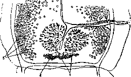 Teniidosis: figure 5 from the 1928–1936 encyclopedia article