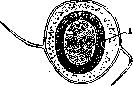 Teniidosis: figure 8 from the 1928–1936 encyclopedia article
