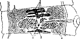 Teniidosis: figure 2 from the 1928–1936 encyclopedia article