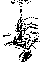 Tonometry: figure 7 from the 1928–1936 encyclopedia article