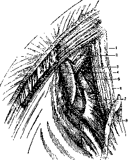 Thoracoplasty: figure 13 from the 1928–1936 encyclopedia article