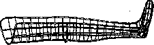 Splints: figure 2 from the 1928–1936 encyclopedia article