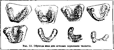 Splints: figure 29 from the 1928–1936 encyclopedia article