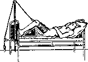 Splints: figure 19 from the 1928–1936 encyclopedia article