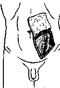 Anus: figure 5 from the 1928–1936 encyclopedia article